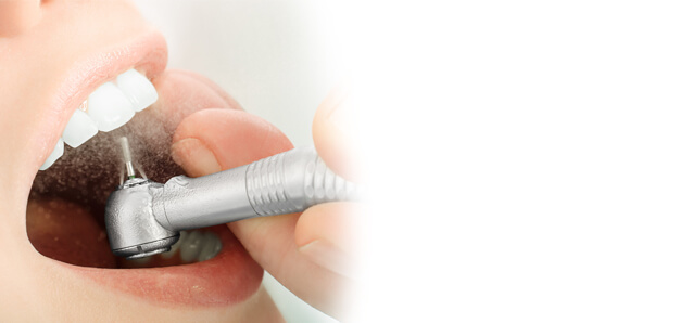 teeth cleaning and polishing