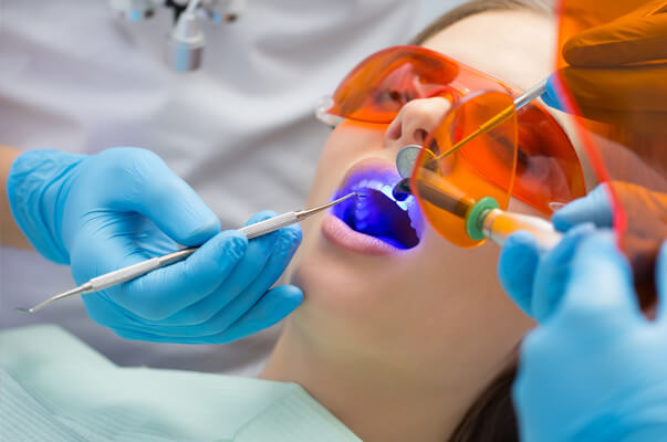 Composite filling